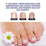 Nail Care Solution