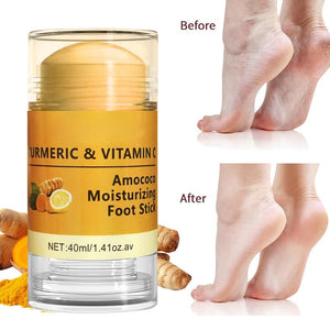 Turmeric Foot Cream