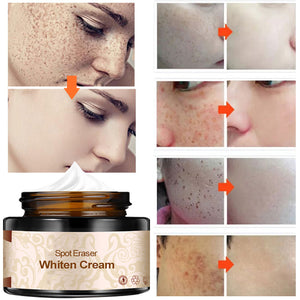 Plant lightening melanin freckle cream